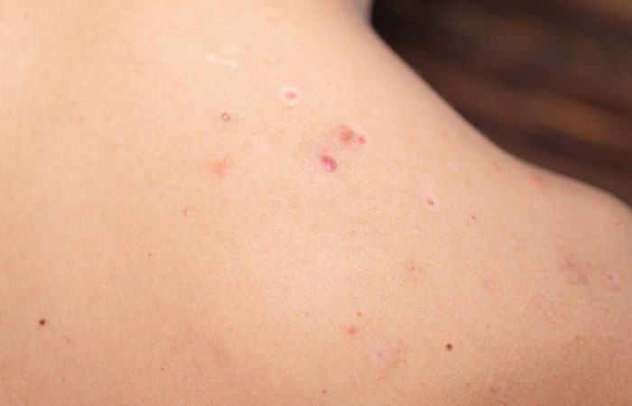  Pigmentation Concerns
