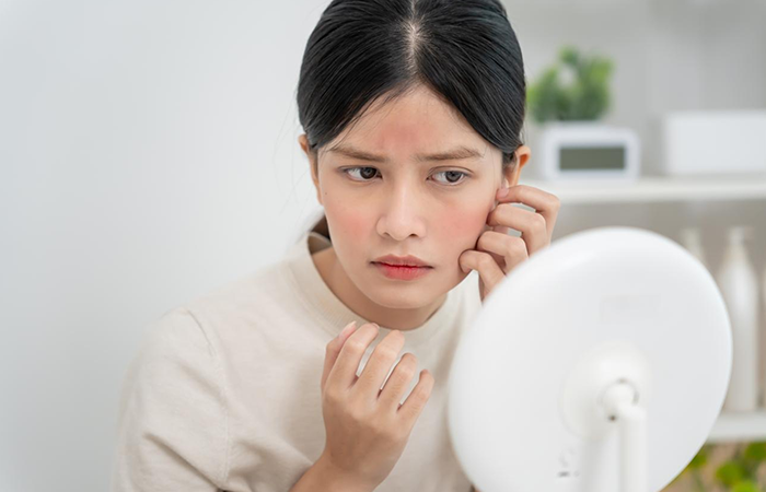 Allergic Reactions in Adolescents

