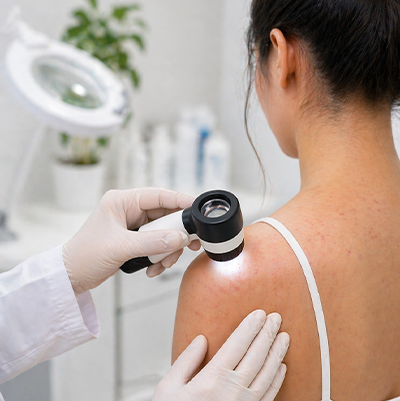 Dermatology Treatment