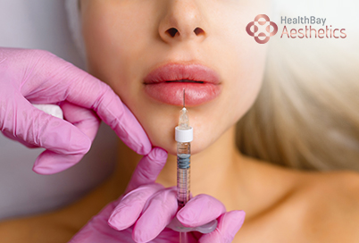Lip Fillers