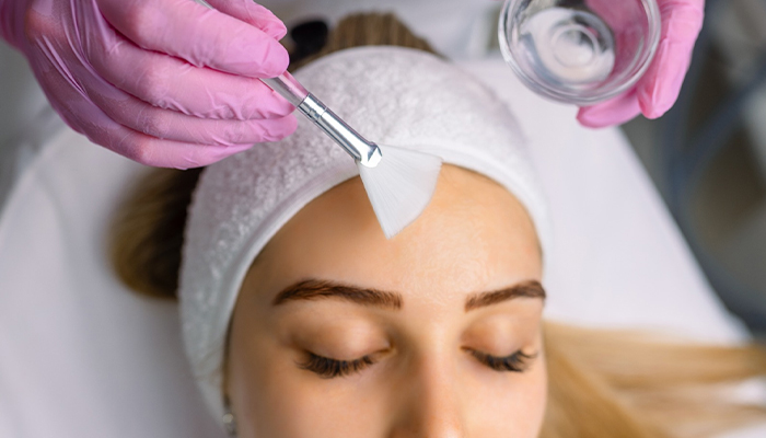 Chemical Peel Treatment for Skin Rejuvenation