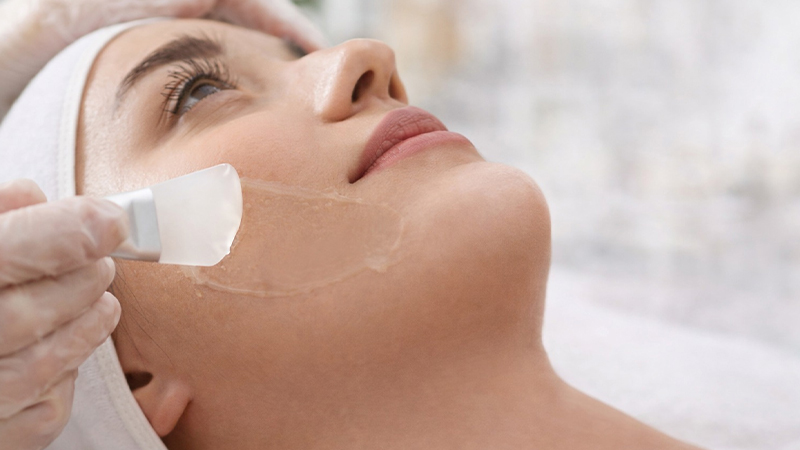  Chemical Peels for Scar Removal