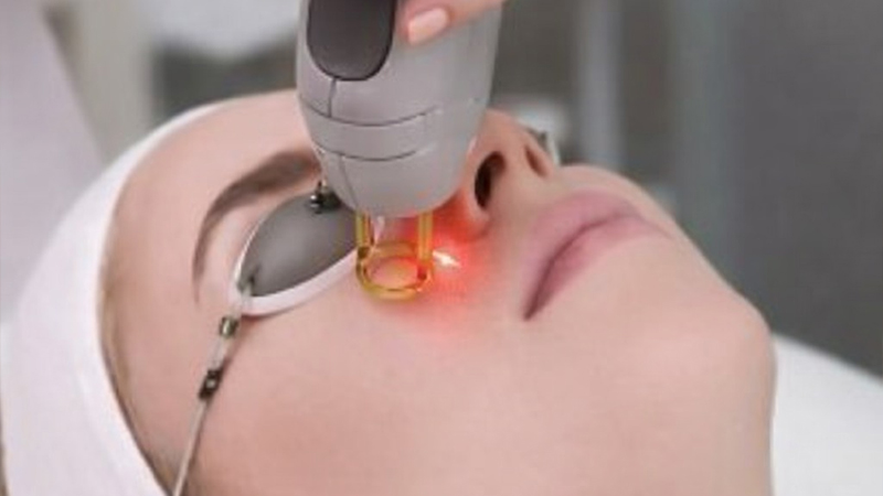 Laser Scar Removal